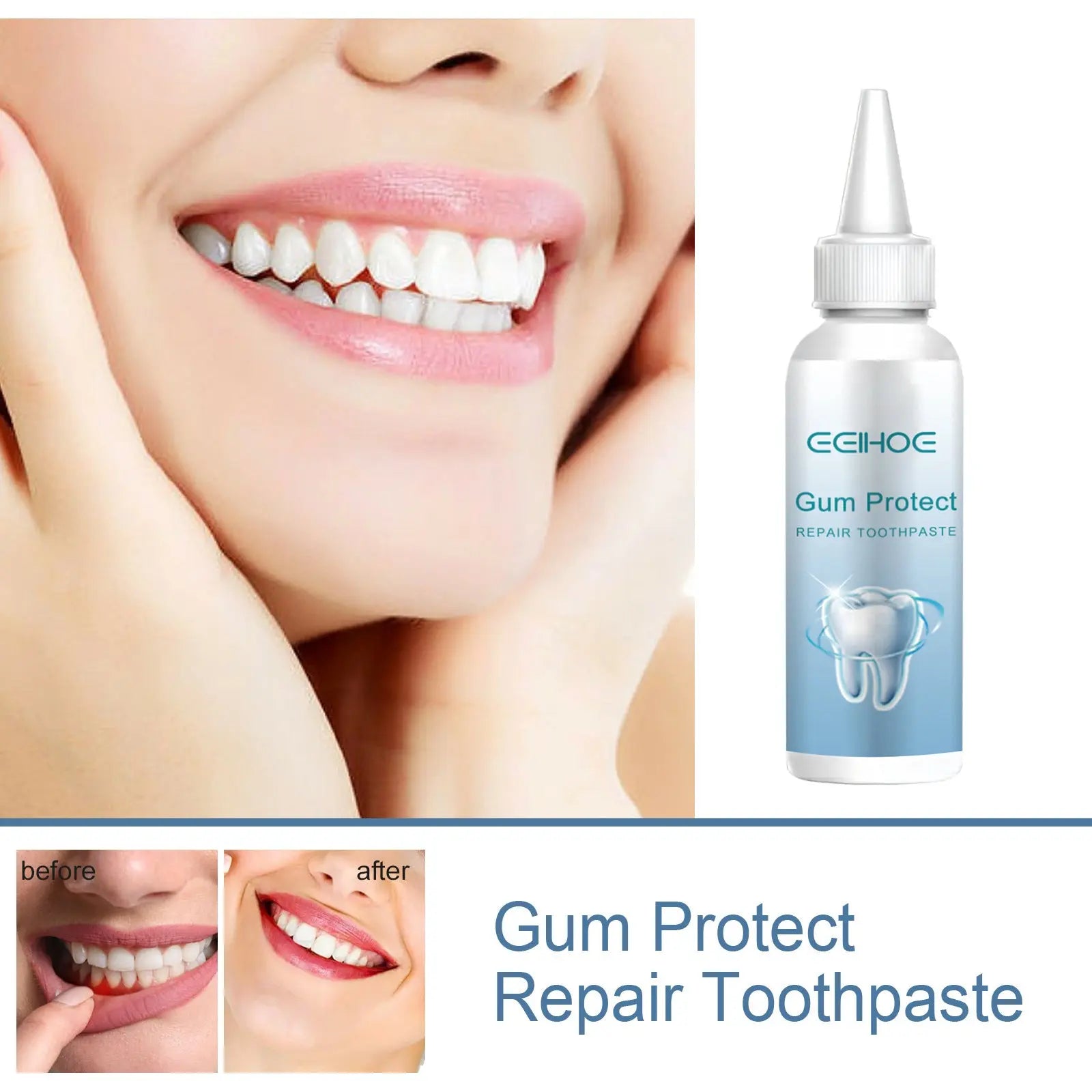 Gum Repair Gel – Ultimate Oral Care for Healthy Gums & Strong Teeth