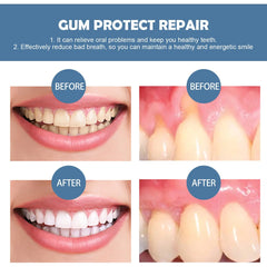 Gum Repair Gel – Ultimate Oral Care for Healthy Gums & Strong Teeth