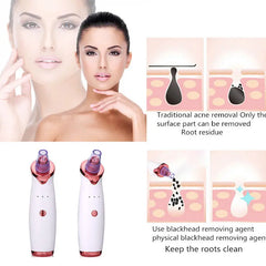 Professional Blackhead Remover Tool | Clear Skin at Home