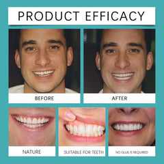 Orthodontic Dentures Kit - Family Shopolf