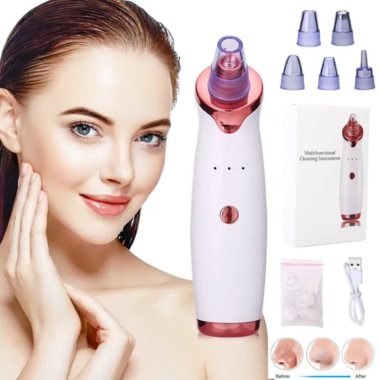 Professional Blackhead Remover Tool | Clear Skin at Home