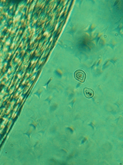 Microscopic view of cells under a greenish tint